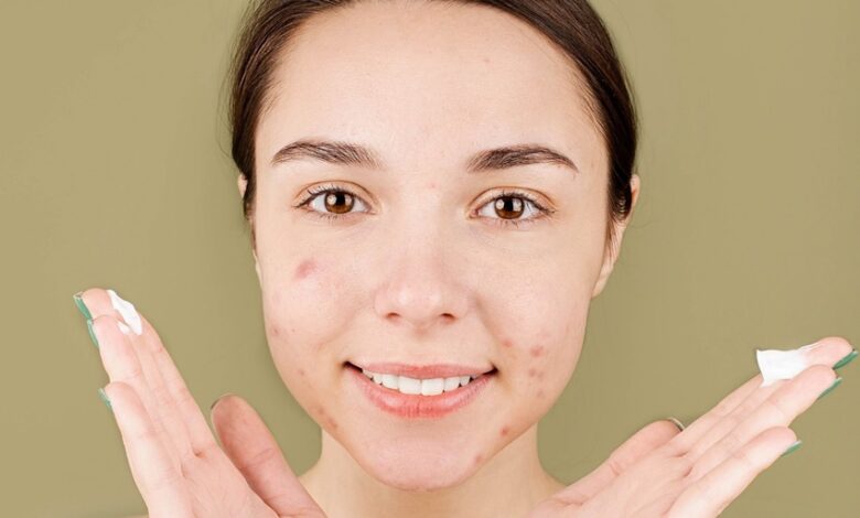 dieta-per-acne